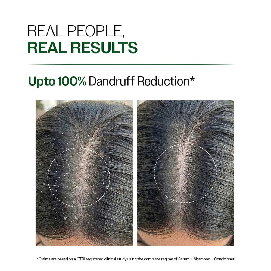 Anti Dandruff Shampoo with Salicylic Acid & Biotin -250Ml